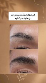 تونیک تقویت مژه و ابرو دکس لاند eyelash lotion حجم 15میل - Image 2