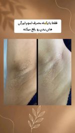 کرم روشن کننده زیر بغل و کشاله ران دکس لاند حجم ۵۰ گرم - Image 2