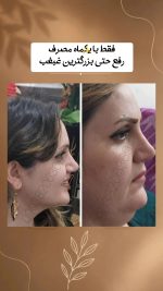 ژل رفع غبغب دکس لاند وزن ۱۲۵ گرم - Image 2