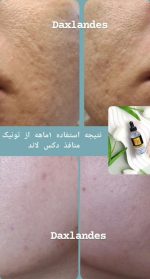 سرم پوست دکس لاند مدل جمع کننده منافذ باز حجم ۶۰ میل - Image 2