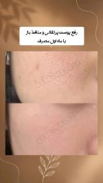 سرم پوست دکس لاند مدل جمع کننده منافذ باز حجم ۶۰ میل - Image 2